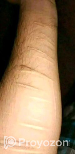 TCM scar removal cream sell deoya hbe
