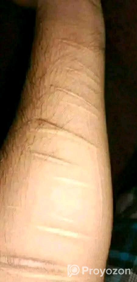 TCM scar removal cream sell deoya hbe