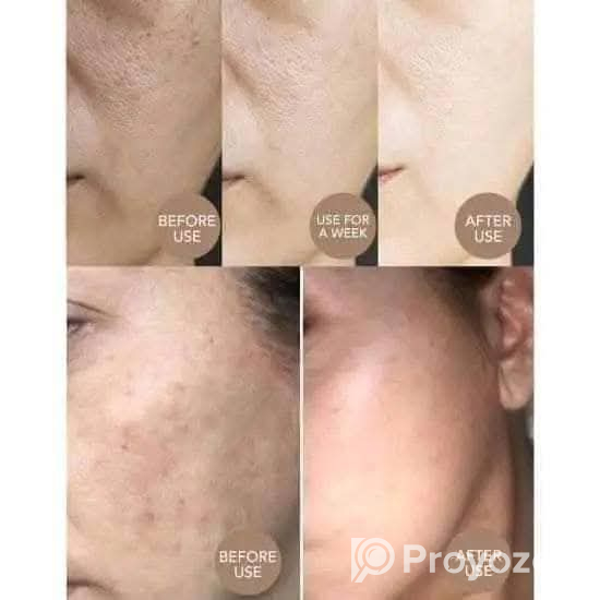 𝗝𝗮𝗽𝗮𝗻 𝗦𝗮𝗸𝘂𝗿𝗮 𝗦𝗸𝗶𝗻𝗰𝗮𝗿𝗲 SET