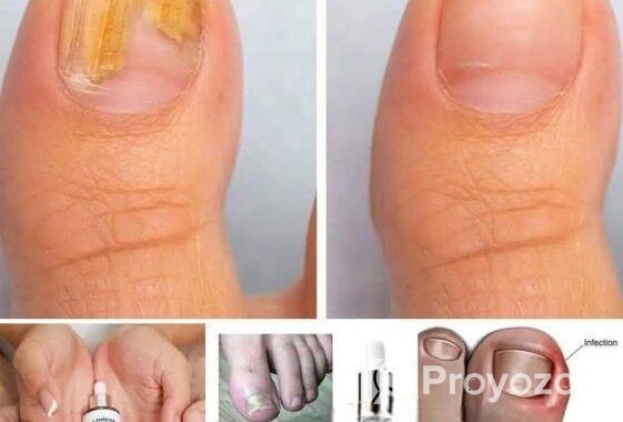 Lanbena Nail repair Essence