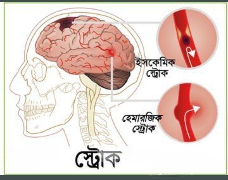 ডাক্তার/ফিজিওথেরাপি