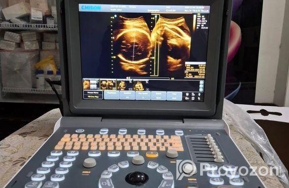 আল্ট্রাসনোগ্রাম Eco 2 Like New