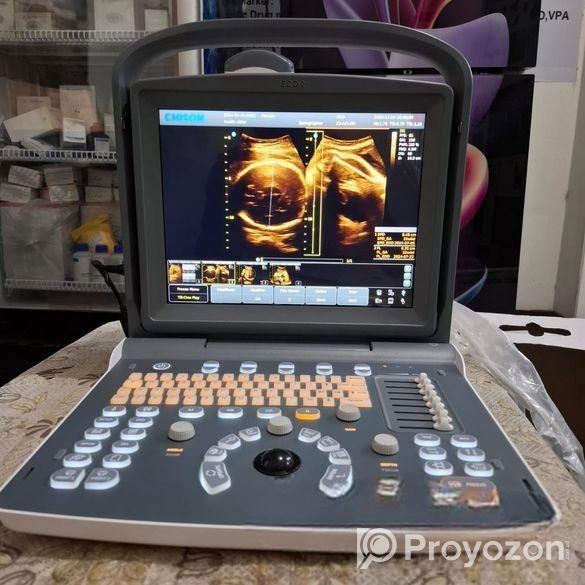 আল্ট্রাসনোগ্রাম Eco 2 Like New