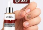 নখের যেকোনো ধরনের সমস্যা দূর করে। ঔষধ