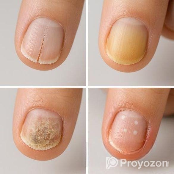 নখের যেকোনো ধরনের সমস্যা দূর করে। ঔষধ