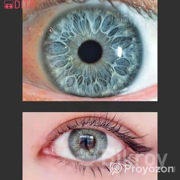 চোখের লেন্স